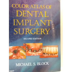 color atlas of dental implant surgery Block